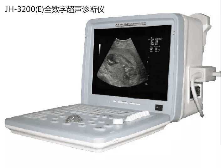 獸用b超廠家供應 全數字b超廠家 掌上b超廠家